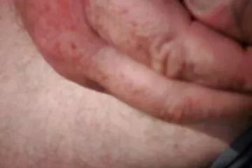 Kéo dài mông xes co trang gà trắng với gà đen.